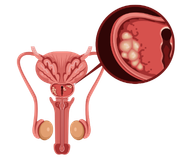 Potence a prostata