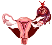 Gynekologie